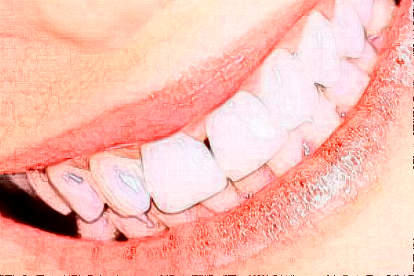苏北人民医院牙齿种植可以选择吗