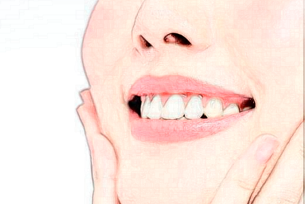 威海市口腔医院龅牙矫正可以信赖吗