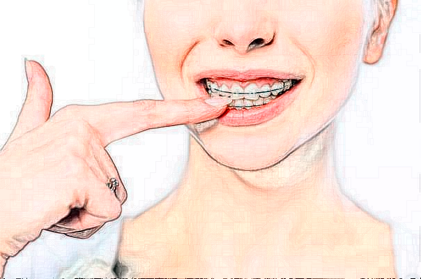 重庆医科大学附属口腔医院牙齿种植水平高的医生