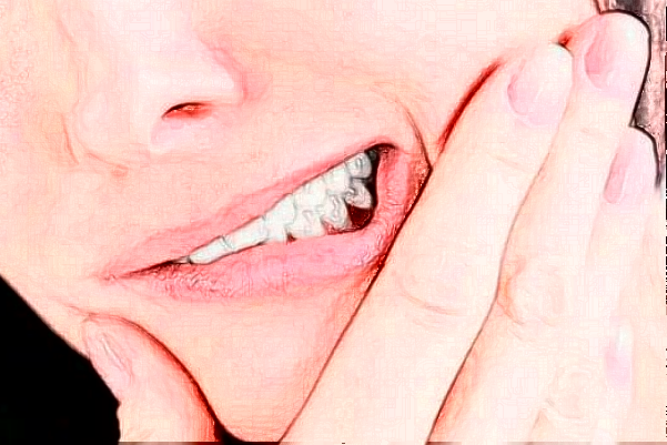 银川市口腔医院全口牙种植手术攻略