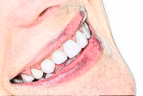 银川市口腔医院牙齿正畸费用高吗