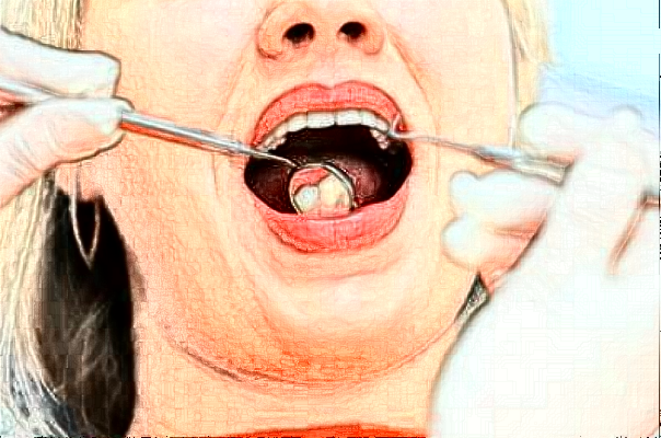 成都市第三人民医院牙齿正畸手术攻略