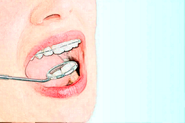 成都高新中诺口腔龅牙矫正几位医生能做
