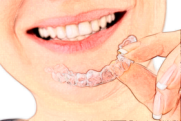 成都高新中诺口腔龅牙矫正几位医生能做